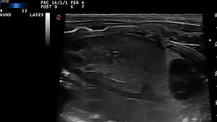 Ultraschall eines Hundewelpens vier Tage vor der Geburt